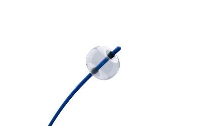 Belon Pembuatan Batu Gastrointestinal Balloon ERCP